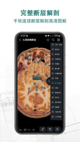 掌上3D解剖app手機(jī)版